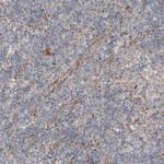 ALS2CR2 Antibody in Immunohistochemistry (Paraffin) (IHC (P))