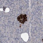ALS2CR2 Antibody in Immunohistochemistry (Paraffin) (IHC (P))