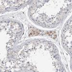 ALS2CR2 Antibody in Immunohistochemistry (Paraffin) (IHC (P))