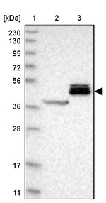 ALS2CR2 Antibody in Western Blot (WB)