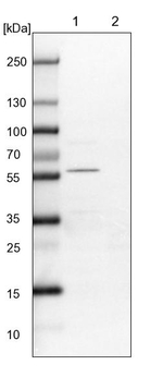 ALS2CR2 Antibody in Western Blot (WB)