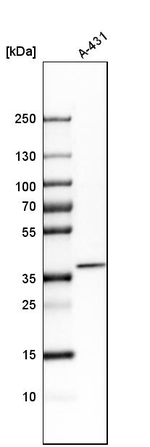 CDCA3 Antibody in Western Blot (WB)