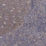 DDX6 Polyclonal Antibody