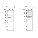 DDX6 Antibody in Western Blot (WB)