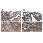 MDH2 Antibody in Immunohistochemistry (Paraffin) (IHC (P))