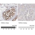 TOP2A Polyclonal Antibody