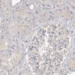 TOP2A Antibody in Immunohistochemistry (Paraffin) (IHC (P))
