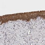CHIC2 Polyclonal Antibody