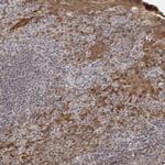 14-3-3 gamma Polyclonal Antibody