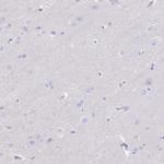 GPR182 Antibody in Immunohistochemistry (Paraffin) (IHC (P))