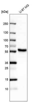 Mig-6 Antibody in Western Blot (WB)