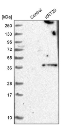 Cytokeratin 20 Antibody in Western Blot (WB)