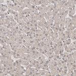 NIK Antibody in Immunohistochemistry (Paraffin) (IHC (P))