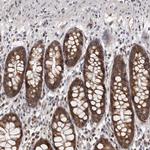 NIK Antibody in Immunohistochemistry (Paraffin) (IHC (P))