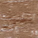 NIK Antibody in Immunohistochemistry (Paraffin) (IHC (P))