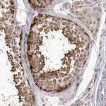 NIK Polyclonal Antibody