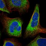 MOK Polyclonal Antibody