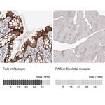 FAS Antibody in Immunohistochemistry (Paraffin) (IHC (P))