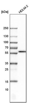 FAS Antibody in Western Blot (WB)