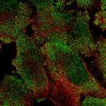 PUM1 Polyclonal Antibody