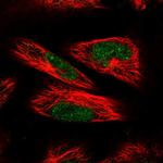 POLR3C Polyclonal Antibody