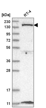 DGKD Antibody in Western Blot (WB)