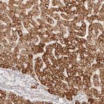 IL1R2 Polyclonal Antibody