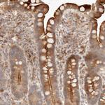 IL1R2 Polyclonal Antibody