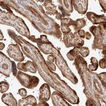 IL1R2 Antibody in Immunohistochemistry (Paraffin) (IHC (P))