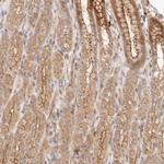 IL1R2 Antibody in Immunohistochemistry (Paraffin) (IHC (P))