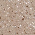 RANK Polyclonal Antibody