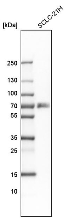 RANK Antibody in Western Blot (WB)