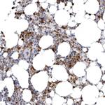 STAP2 Polyclonal Antibody