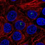 Coilin Polyclonal Antibody