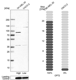 CPT2 Antibody in Western Blot (WB)