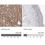 CPT2 Polyclonal Antibody