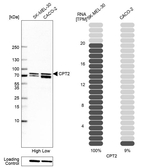 CPT2 Antibody in Western Blot (WB)