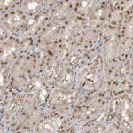 c-MAF Antibody in Immunohistochemistry (Paraffin) (IHC (P))
