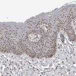 c-MAF Antibody in Immunohistochemistry (Paraffin) (IHC (P))