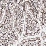 c-MAF Antibody in Immunohistochemistry (Paraffin) (IHC (P))