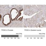 TPD52 Antibody in Immunohistochemistry (Paraffin) (IHC (P))