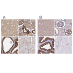 TPD52 Antibody in Immunohistochemistry (Paraffin) (IHC (P))