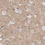 TPD52 Antibody in Immunohistochemistry (Paraffin) (IHC (P))