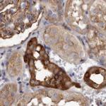 TPD52 Antibody in Immunohistochemistry (Paraffin) (IHC (P))