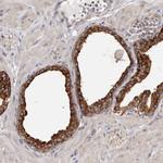 TPD52 Antibody in Immunohistochemistry (Paraffin) (IHC (P))