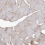 TPD52 Antibody in Immunohistochemistry (Paraffin) (IHC (P))