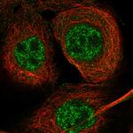 EXO5 Polyclonal Antibody