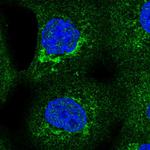 SLC25A24 Polyclonal Antibody