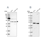 SLC25A24 Antibody in Western Blot (WB)