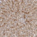 ALS2CR2 Polyclonal Antibody